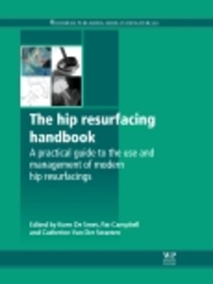 cover image of The Hip Resurfacing Handbook
